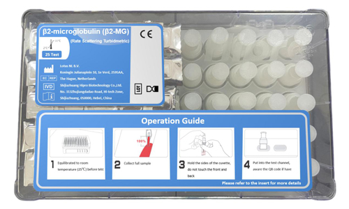 Beta 2 Microglobulin Test